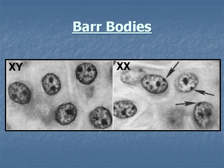 Barr Bodies 