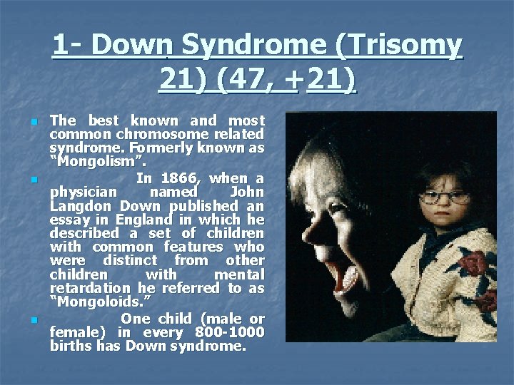 1 - Down Syndrome (Trisomy 21) (47, +21) n n n The best known