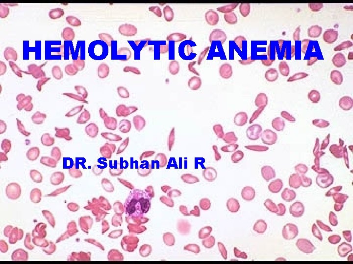 HEMOLYTIC ANEMIA DR. Subhan Ali R 