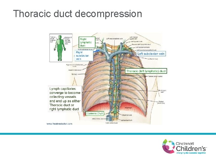 Thoracic duct decompression 