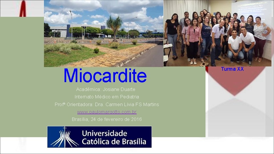 Miocardite Acadêmica: Josiane Duarte Internato Médico em Pediatria Profª Orientadora: Dra. Carmen Lívia FS