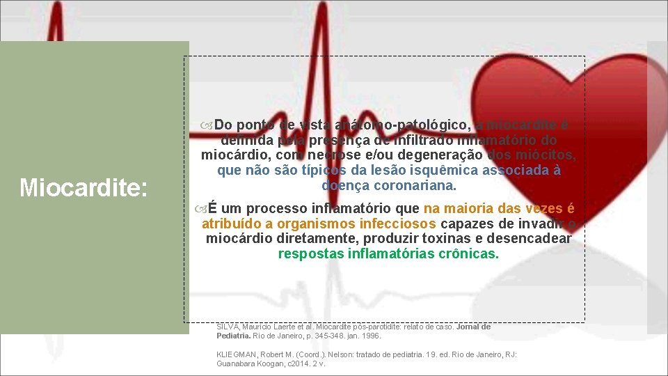 Miocardite: Do ponto de vista anátomo-patológico, a miocardite é definida pela presença de infiltrado