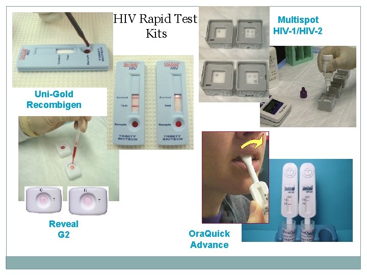 HIV Rapid Test Kits Uni-Gold Recombigen Reveal G 2 Ora. Quick Advance Multispot HIV-1/HIV-2 HIV Rapid Test Kits Uni-Gold Recombigen Reveal G 2 Ora. Quick Advance Multispot HIV-1/HIV-2