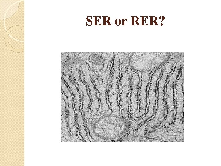 SER or RER? 