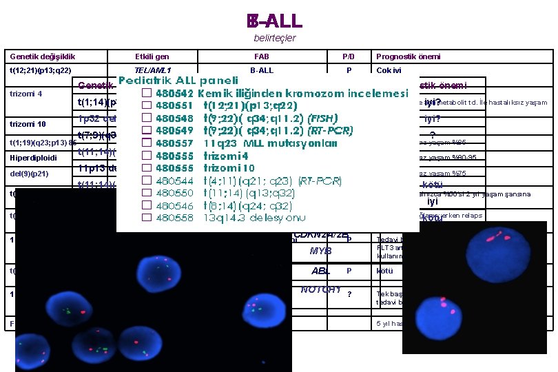 B-ALL T-ALL belirteçler Genetik değişiklik Etkili gen FAB P/D t(12; 21)(p 13; q 22)
