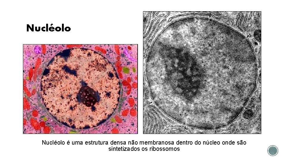 Nucléolo é uma estrutura densa não membranosa dentro do núcleo onde são sintetizados os