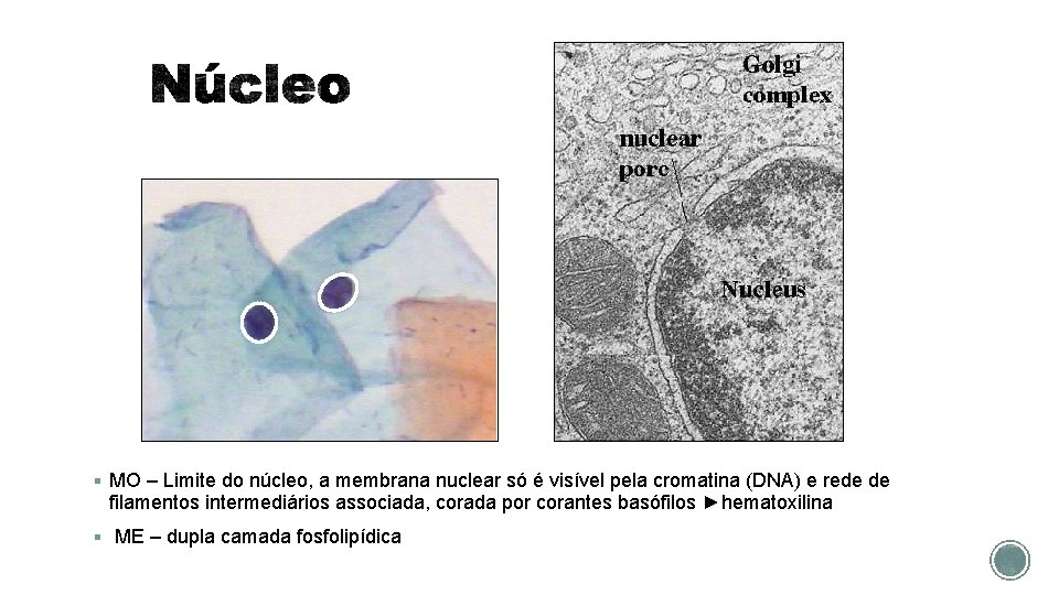 § MO – Limite do núcleo, a membrana nuclear só é visível pela cromatina