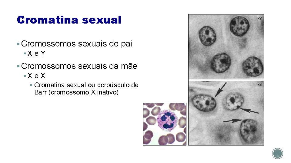 Cromatina sexual § Cromossomos sexuais do pai §X e Y § Cromossomos sexuais da