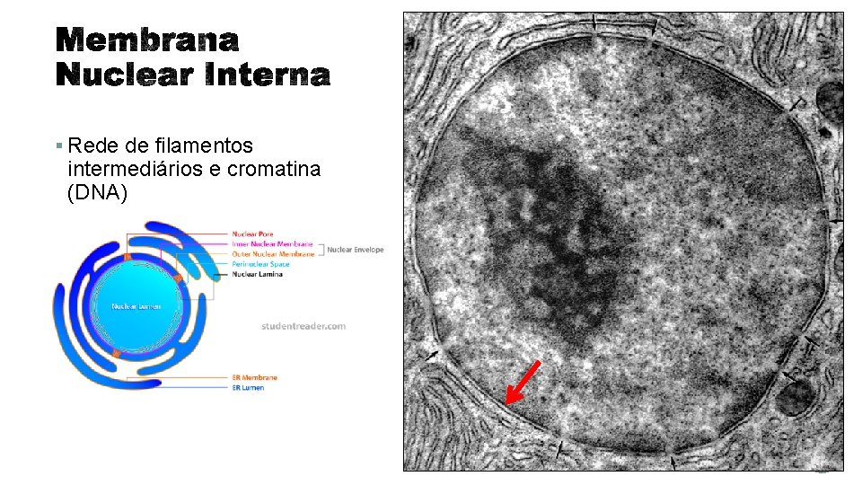 § Rede de filamentos intermediários e cromatina (DNA) 