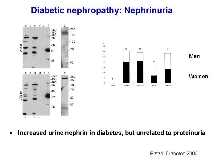 Diabetic nephropathy: Nephrinuria Men Women § Increased urine nephrin in diabetes, but unrelated to