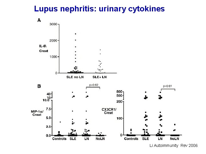 Lupus nephritis: urinary cytokines Li Autoimmunity Rev 2006 