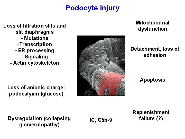 Podocyte injury Mitochondrial dysfunction Loss of filtration slits and slit diaphragms - Mutations -Transcription