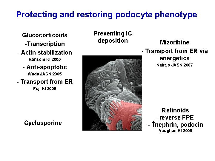 Protecting and restoring podocyte phenotype Glucocorticoids -Transcription - Actin stabilization Ransom KI 2005 -