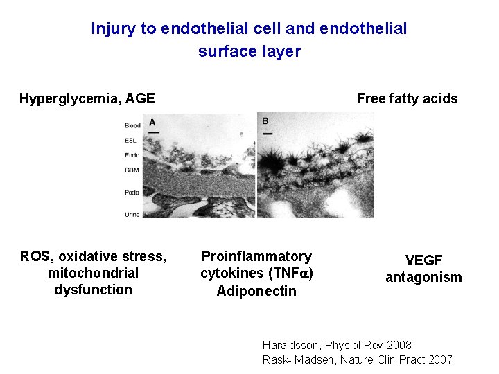 Injury to endothelial cell and endothelial surface layer Hyperglycemia, AGE ROS, oxidative stress, mitochondrial
