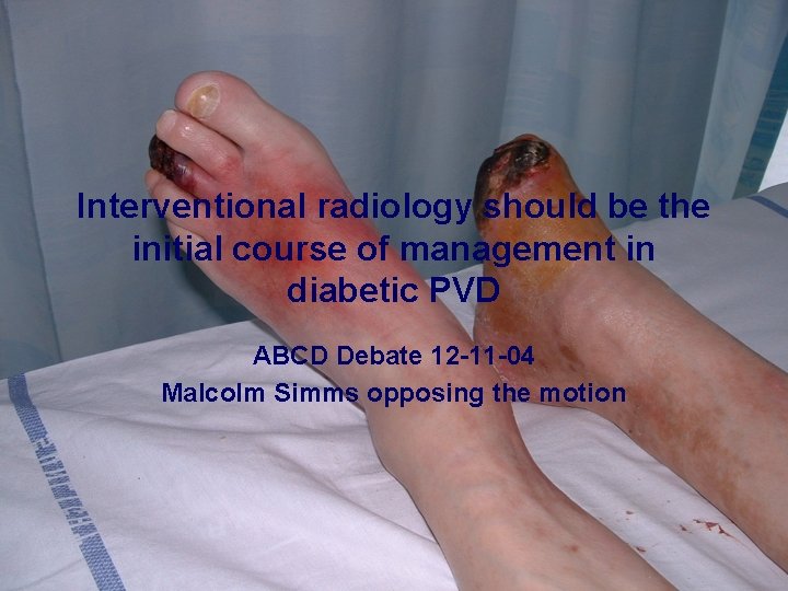 Interventional radiology should be the initial course of management in diabetic PVD ABCD Debate