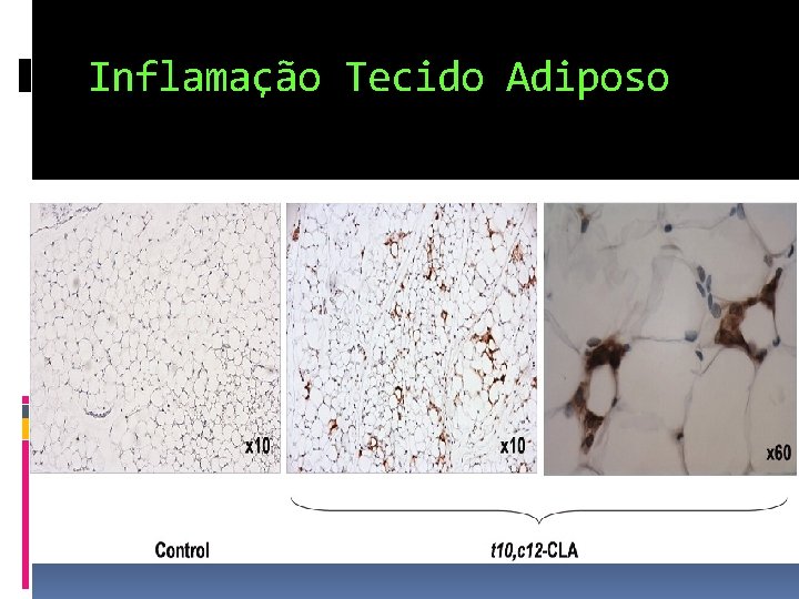 Inflamação Tecido Adiposo 