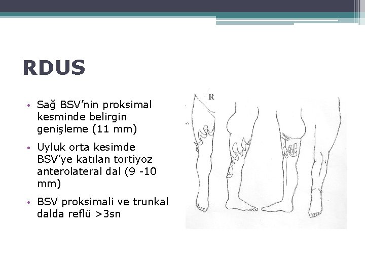 RDUS • Sağ BSV’nin proksimal kesminde belirgin genişleme (11 mm) • Uyluk orta kesimde