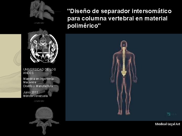 "Diseño de separador intersomático para columna vertebral en material polimérico" UNIVERSIDAD DE LOS ANDES