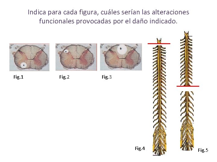 Indica para cada figura, cuáles serían las alteraciones funcionales provocadas por el daño indicado.