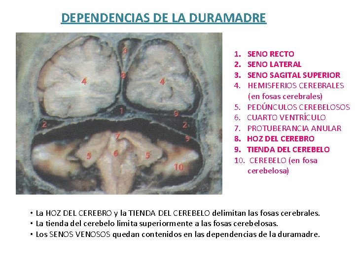 DEPENDENCIAS DE LA DURAMADRE 1. 2. 3. 4. SENO RECTO SENO LATERAL SENO SAGITAL