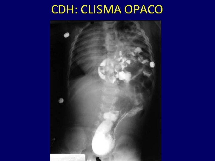 CDH: CLISMA OPACO 