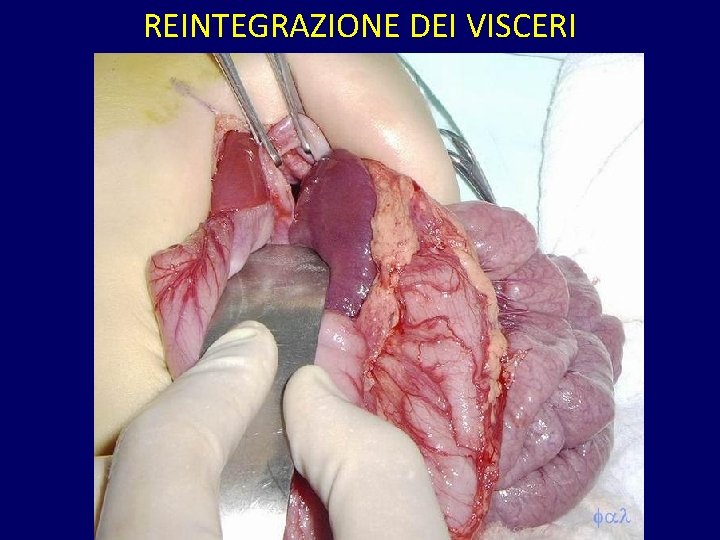 REINTEGRAZIONE DEI VISCERI 