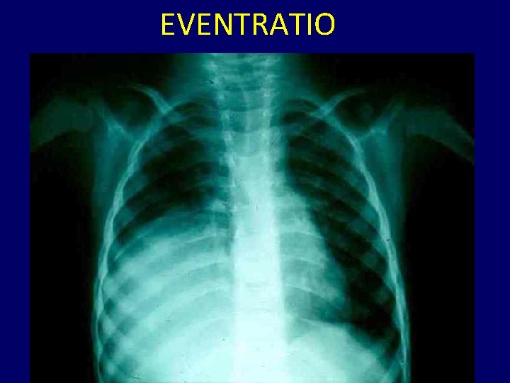 EVENTRATIO 