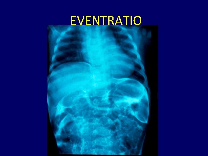 EVENTRATIO 