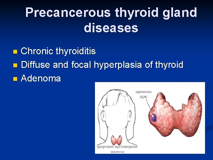 Precancerous thyroid gland diseases Chronic thyroiditis n Diffuse and focal hyperplasia of thyroid n