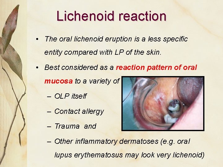 Lichenoid reaction • The oral lichenoid eruption is a less speciﬁc entity compared with