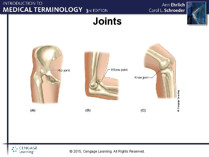 © Cengage Learning Joints © 2015, Cengage Learning. All Rights Reserved. 