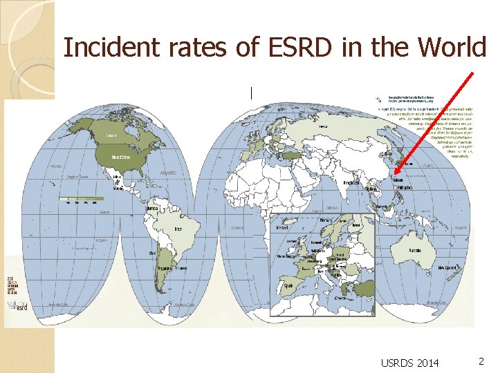 Incident rates of ESRD in the World USRDS 2014 2 