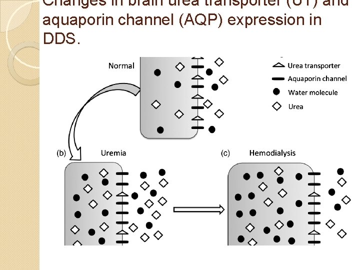 Changes in brain urea transporter (UT) and aquaporin channel (AQP) expression in DDS. 