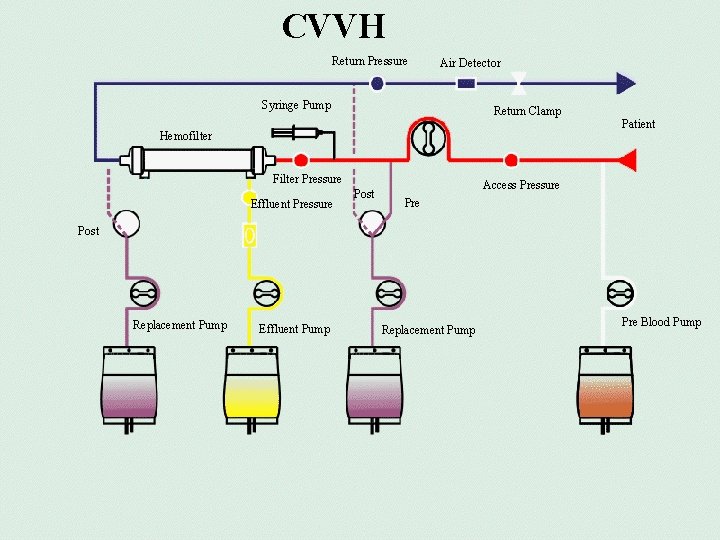 CVVH Return Pressure Air Detector Syringe Pump Return Clamp Hemofilter Filter Pressure Effluent Pressure