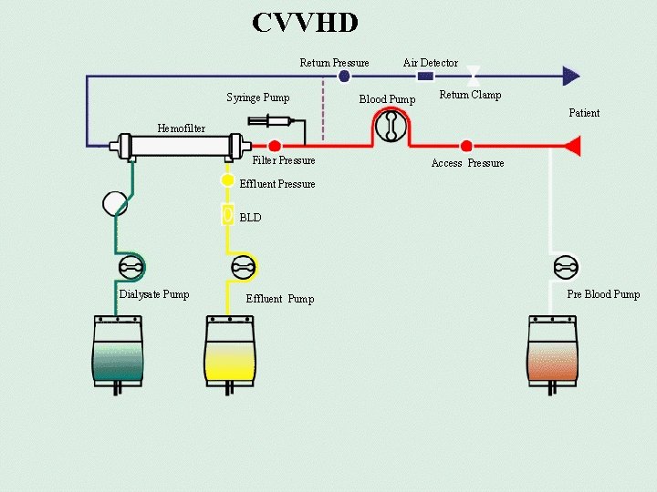 CVVHD Return Pressure Syringe Pump Air Detector Blood Pump Return Clamp Patient Hemofilter Filter