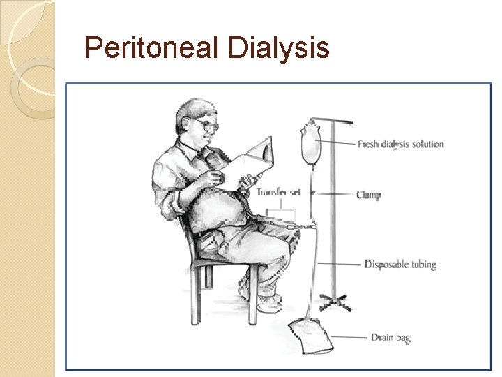 Peritoneal Dialysis 