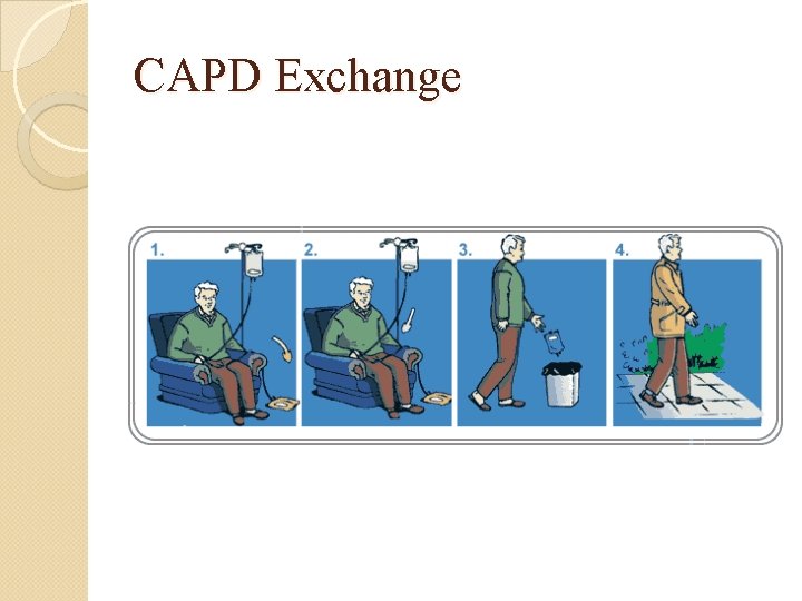 CAPD Exchange 