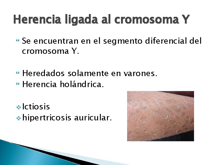Herencia ligada al cromosoma Y Se encuentran en el segmento diferencial del cromosoma Y.