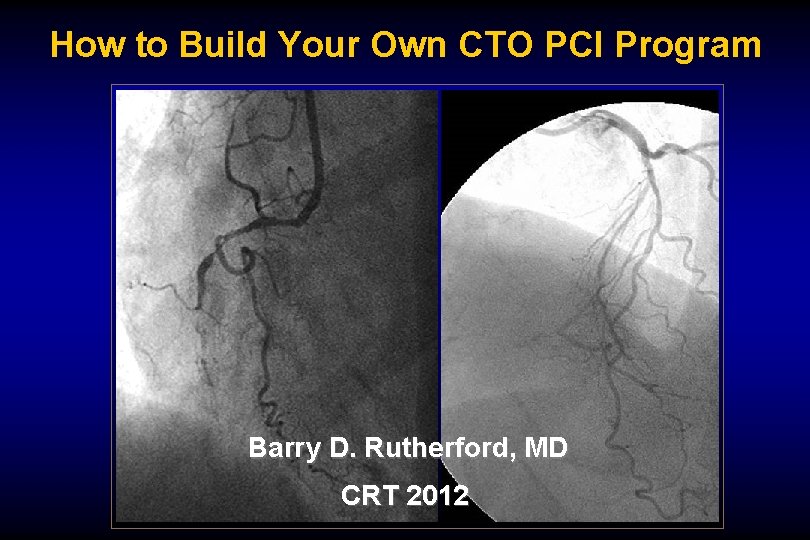 How to Build Your Own CTO PCI Program Barry D. Rutherford, MD CRT 2012