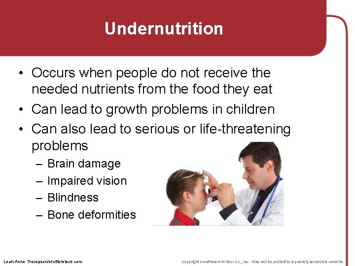 Undernutrition • Occurs when people do not receive the needed nutrients from the food