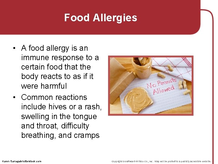 Food Allergies • A food allergy is an immune response to a certain food