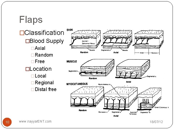 Flaps �Classification �Blood Supply �Axial �Random �Free �Location �Local �Regional �Distal free 10 www.