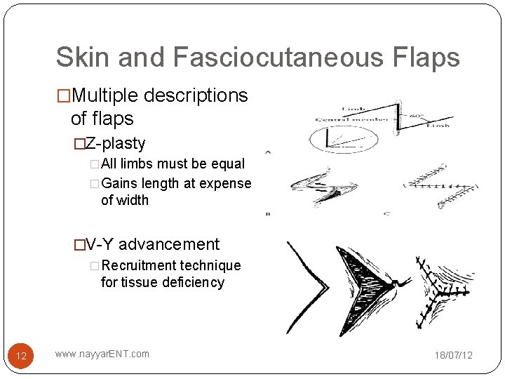 Skin and Fasciocutaneous Flaps �Multiple descriptions of flaps �Z-plasty �All limbs must be equal