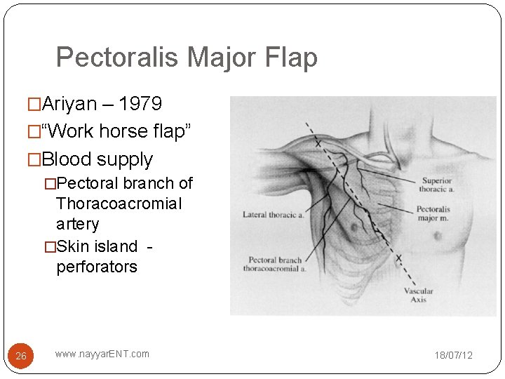 Pectoralis Major Flap �Ariyan – 1979 �“Work horse flap” �Blood supply �Pectoral branch of