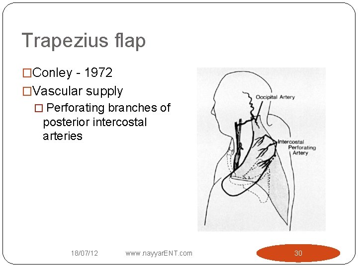 Trapezius flap �Conley - 1972 �Vascular supply � Perforating branches of posterior intercostal arteries