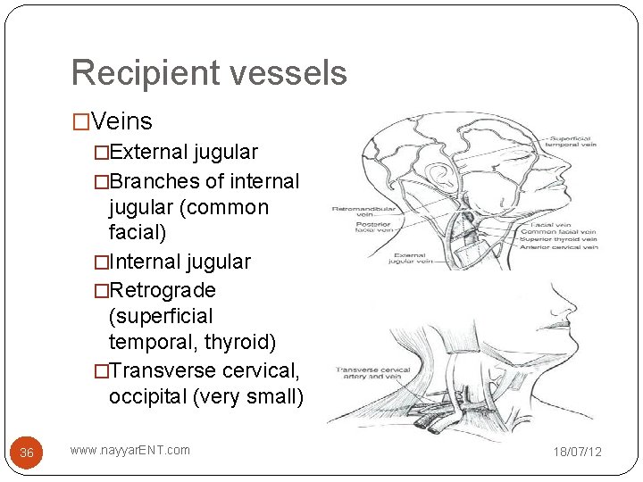 Recipient vessels �Veins �External jugular �Branches of internal jugular (common facial) �Internal jugular �Retrograde