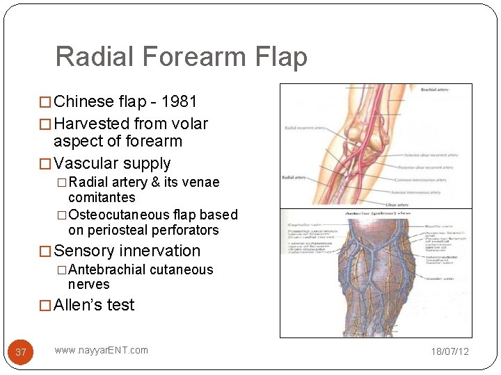Radial Forearm Flap � Chinese flap - 1981 � Harvested from volar aspect of