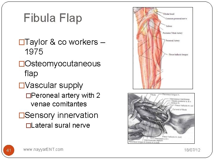 Fibula Flap �Taylor & co workers – 1975 �Osteomyocutaneous flap �Vascular supply �Peroneal artery