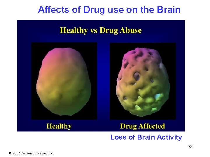 Affects of Drug use on the Brain Loss of Brain Activity 52 © 2012 Affects of Drug use on the Brain Loss of Brain Activity 52 © 2012