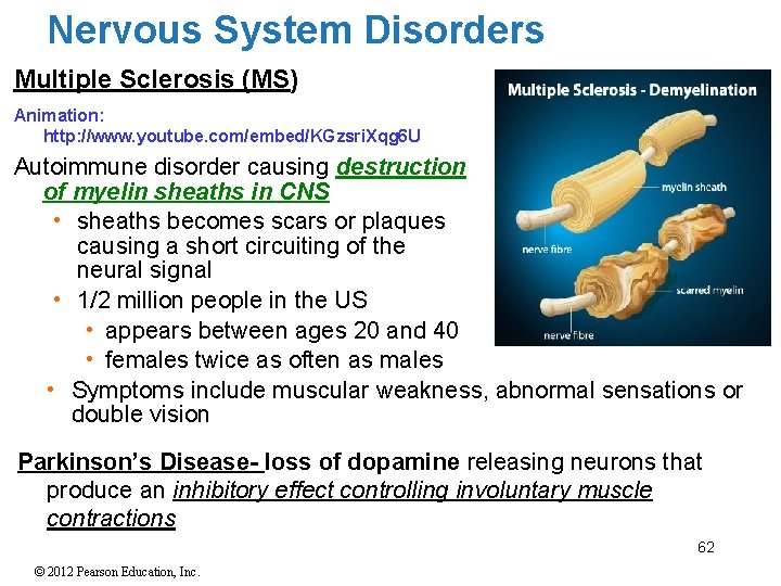 Nervous System Disorders Multiple Sclerosis (MS) Animation: http: //www. youtube. com/embed/KGzsri. Xqg 6 U Nervous System Disorders Multiple Sclerosis (MS) Animation: http: //www. youtube. com/embed/KGzsri. Xqg 6 U